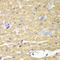 HCLS1 Associated Protein X-1 antibody, LS-C334130, Lifespan Biosciences, Immunohistochemistry paraffin image 
