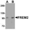 FRAS1 Related Extracellular Matrix 2 antibody, LS-B5304, Lifespan Biosciences, Western Blot image 