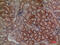 Dual specificity protein phosphatase 3 antibody, A06135-1, Boster Biological Technology, Immunohistochemistry paraffin image 
