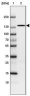 Integrin Subunit Alpha V antibody, NBP1-85746, Novus Biologicals, Western Blot image 
