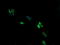 Armadillo Repeat Containing 1 antibody, LS-C174311, Lifespan Biosciences, Immunofluorescence image 