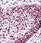 SF3b155 antibody, LS-C169005, Lifespan Biosciences, Immunohistochemistry frozen image 