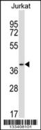 Progestin And AdipoQ Receptor Family Member 6 antibody, 57-189, ProSci, Western Blot image 