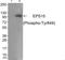 Epidermal Growth Factor Receptor Pathway Substrate 15 antibody, AP55818PU-S, Origene, Western Blot image 