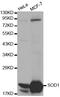 Superoxide Dismutase 1 antibody, A0274, ABclonal Technology, Western Blot image 