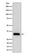 Complex I intermediate-associated protein 30, mitochondrial antibody, M10145-1, Boster Biological Technology, Western Blot image 