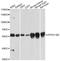 ATPase H+ Transporting V1 Subunit B2 antibody, STJ22729, St John