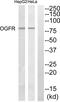 Opioid growth factor receptor antibody, abx014684, Abbexa, Western Blot image 