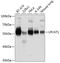 Lysophosphatidylcholine Acyltransferase 1 antibody, 19-515, ProSci, Western Blot image 