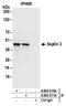 Septin-2 antibody, A304-211A, Bethyl Labs, Immunoprecipitation image 