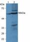 Lysophosphatidylcholine Acyltransferase 3 antibody, MBS2001996, MyBioSource, Western Blot image 