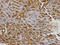 SPARC antibody, A00862, Boster Biological Technology, Immunohistochemistry paraffin image 