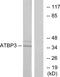 Cytosolic Thiouridylase Subunit 1 antibody, GTX87262, GeneTex, Western Blot image 