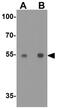 Cereblon antibody, GTX31611, GeneTex, Western Blot image 