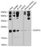 Dual Specificity Phosphatase 14 antibody, GTX64689, GeneTex, Western Blot image 