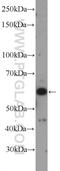 LIM/homeobox protein Lhx6 antibody, 21516-1-AP, Proteintech Group, Western Blot image 