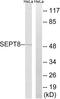 Septin 8 antibody, LS-C120358, Lifespan Biosciences, Western Blot image 