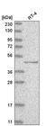 Tumor Protein P73 antibody, HPA027314, Atlas Antibodies, Western Blot image 