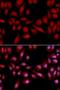 Proteasome Subunit Alpha 2 antibody, LS-C332124, Lifespan Biosciences, Immunofluorescence image 