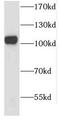 Chromosome Segregation 1 Like antibody, FNab02012, FineTest, Western Blot image 