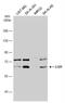 Leucine Rich Glioma Inactivated 1 antibody, NBP1-33087, Novus Biologicals, Western Blot image 