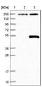 Beta-1,4-Glucuronyltransferase 1 antibody, NBP1-88952, Novus Biologicals, Western Blot image 