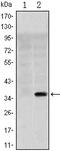 Solute Carrier Family 22 Member 1 antibody, MA5-15730, Invitrogen Antibodies, Western Blot image 