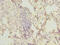O-Linked N-Acetylglucosamine (GlcNAc) Transferase antibody, A56310-100, Epigentek, Immunohistochemistry paraffin image 