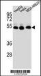Tubulin Beta 2B Class IIb antibody, TA324449, Origene, Western Blot image 