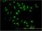 Nuclear Receptor Subfamily 0 Group B Member 1 antibody, H00000190-M03, Novus Biologicals, Immunocytochemistry image 