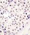 Histone-lysine N-methyltransferase MLL3 antibody, 61-300, ProSci, Immunohistochemistry frozen image 