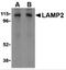 Lysosomal Associated Membrane Protein 2 antibody, 3627, ProSci Inc, Western Blot image 