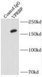 DDB1 And CUL4 Associated Factor 1 antibody, FNab09424, FineTest, Immunoprecipitation image 
