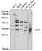 Glutathione S-Transferase Theta 1 antibody, 15-311, ProSci, Western Blot image 