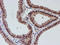 L1CAM antibody, TA502360, Origene, Immunohistochemistry paraffin image 