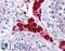 Dual specificity protein phosphatase 16 antibody, LS-B1792, Lifespan Biosciences, Immunohistochemistry paraffin image 