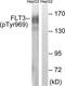 Fms Related Tyrosine Kinase 3 antibody, TA312973, Origene, Western Blot image 