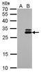 Kallikrein-7 antibody, LS-B13124, Lifespan Biosciences, Western Blot image 