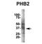 Rea antibody, NBP1-98312, Novus Biologicals, Immunoprecipitation image 