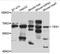 YES Proto-Oncogene 1, Src Family Tyrosine Kinase antibody, LS-B14851, Lifespan Biosciences, Western Blot image 