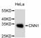 CNN1 antibody, abx125319, Abbexa, Western Blot image 