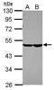 Carbohydrate sulfotransferase 7 antibody, GTX120778, GeneTex, Western Blot image 