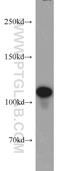 Nuclear pore complex protein Nup98-Nup96 antibody, 12329-1-AP, Proteintech Group, Western Blot image 