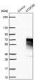 Coiled-Coil Domain Containing 86 antibody, PA5-59617, Invitrogen Antibodies, Western Blot image 