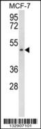Stearoyl-CoA Desaturase 5 antibody, 56-815, ProSci, Western Blot image 