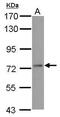 Nuclear pore complex protein Nup98-Nup96 antibody, PA5-34828, Invitrogen Antibodies, Western Blot image 