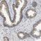Fission, Mitochondrial 1 antibody, NBP1-85664, Novus Biologicals, Immunohistochemistry paraffin image 