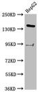 INO80 Complex ATPase Subunit antibody, LS-C680664, Lifespan Biosciences, Western Blot image 