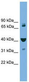 VPS16 Core Subunit Of CORVET And HOPS Complexes antibody, TA344639, Origene, Western Blot image 