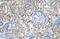 Armadillo Repeat Containing X-Linked 6 antibody, PA5-42600, Invitrogen Antibodies, Immunohistochemistry frozen image 